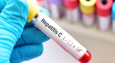 hepatitis c b