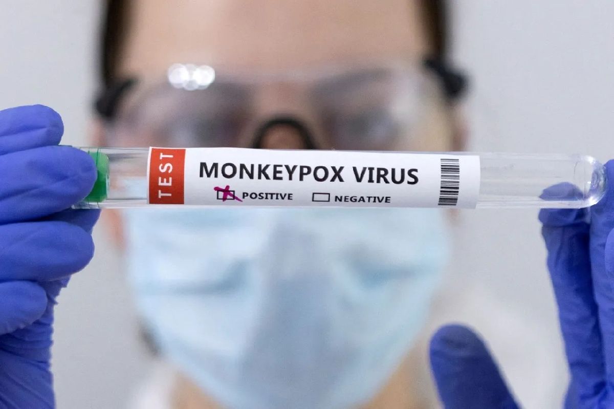 Estados Unidos declara emergencia de salud pública por brote de viruela del mono