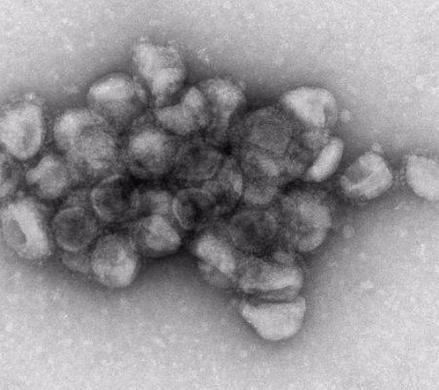 Investigadores descubren un polímero natural con efecto antiviral contra el SARS-CoV-2