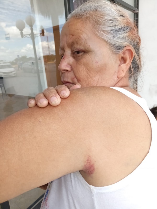 Una mujer denuncia lesiones por parte de una vecina del barrio el Alto
