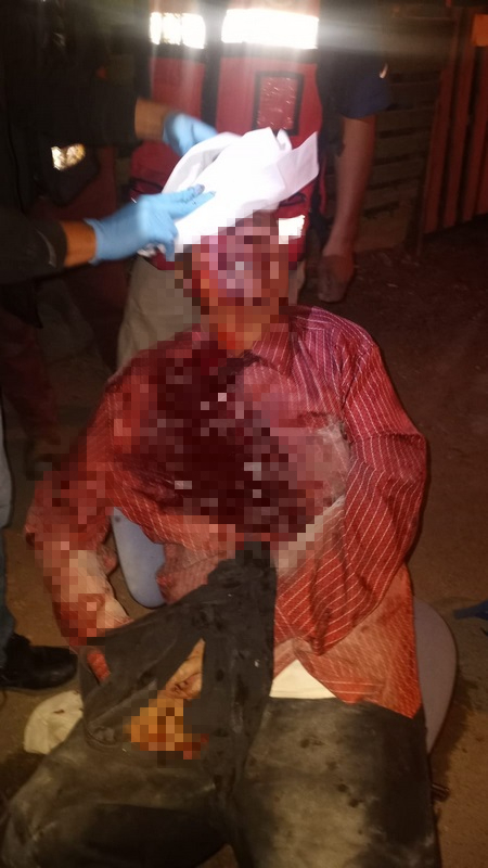 GOLPEAN A PERSONA AL SALIR DE UN BAILE EN PALAÚ