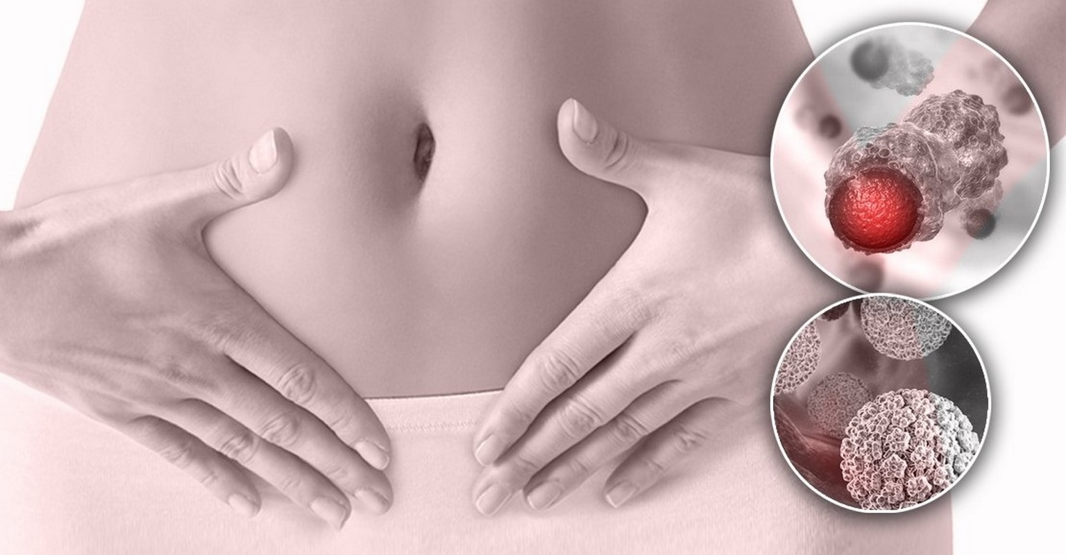Registra Acuña alto índice de mujeres con cáncer