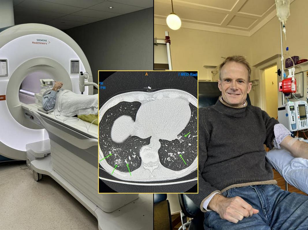 Doctor con cáncer terminal se somete a su propio tratamiento único en el mundo y se recupera por completo