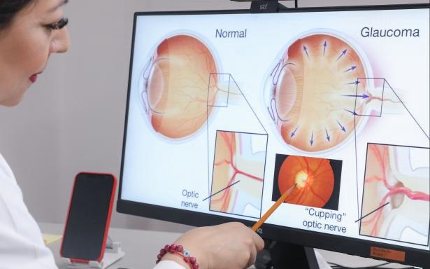 Brinda IMSS Coahuila atención y tratamiento para pacientes con glaucoma