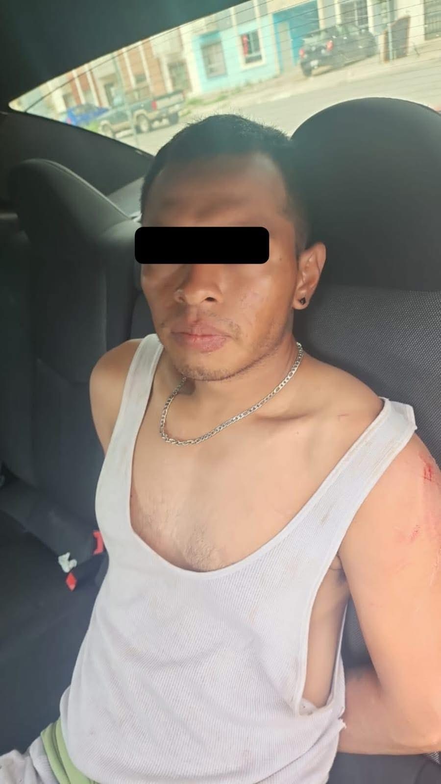 Hombre con quemaduras en Hacienda Narro; detienen al presunto agresor