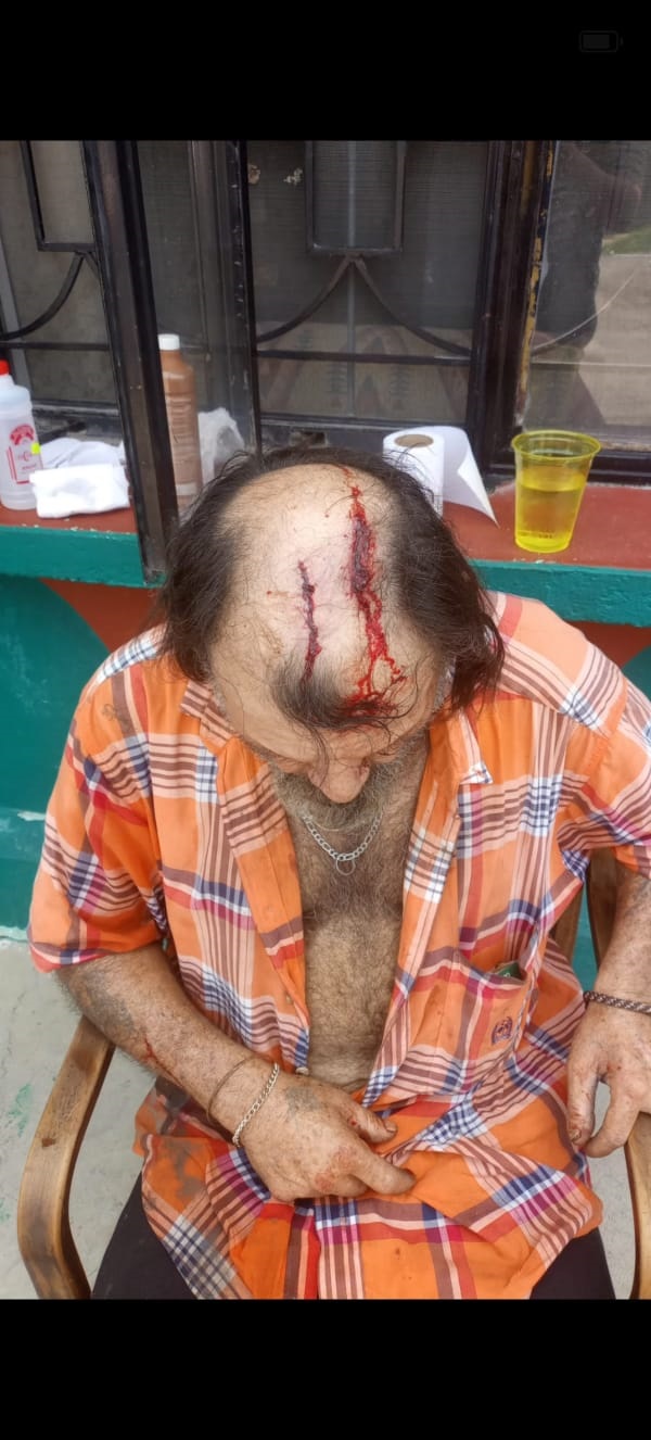 LESIONAN A ABUELO CON UN PALO EN LA CABEZA EN MÚZQUIZ