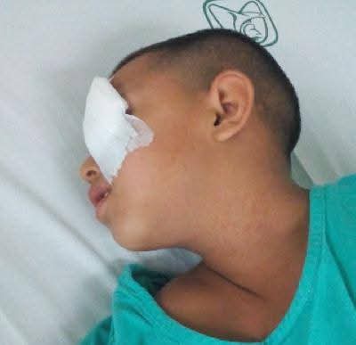 Inició proceso legal para reparación de daños contra menor lesionado en riña 